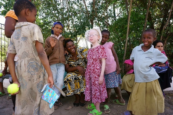 Albino Children Albino Children