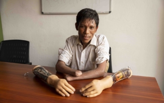 Aakash sitting at a table, looking excited, with a pair of prosthetic hands placed in front of him.