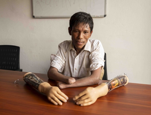 Joni’s House Provided New Hands and Hope for Aakash