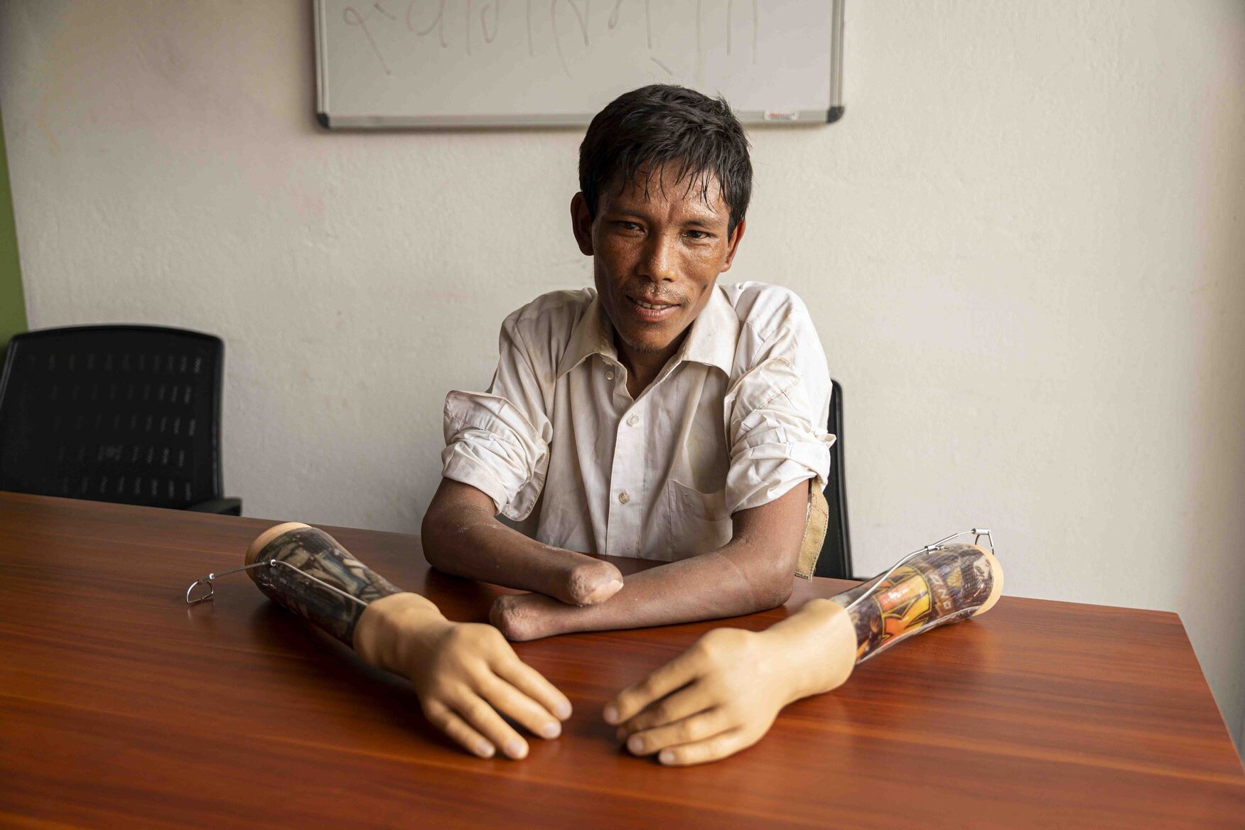 Aakash sitting at a table, looking excited, with a pair of prosthetic hands placed in front of him.